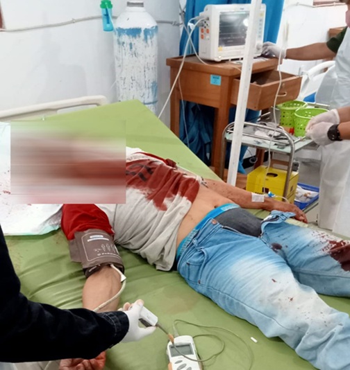 (Korban penikaman tngah menjalani penanganan medis di RSUD Paniai)