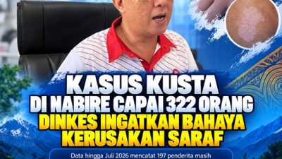 (Kasus Kusta di Nabire Capai 322 Orang, Dinkes Ingatkan Bahaya Kerusakan Saraf)